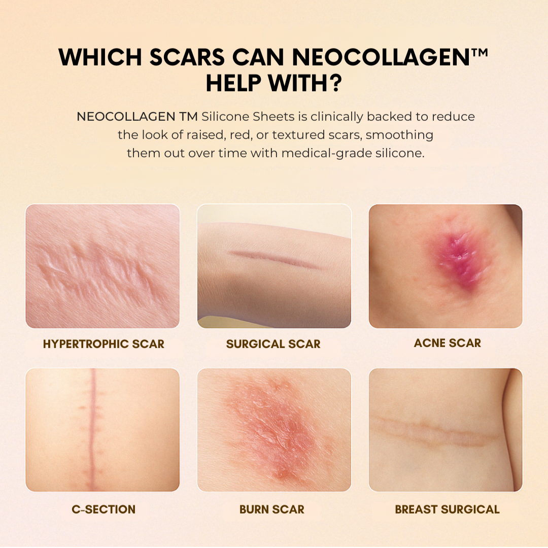 NEOCOLLAGEN™ Silicone Scar Sheets