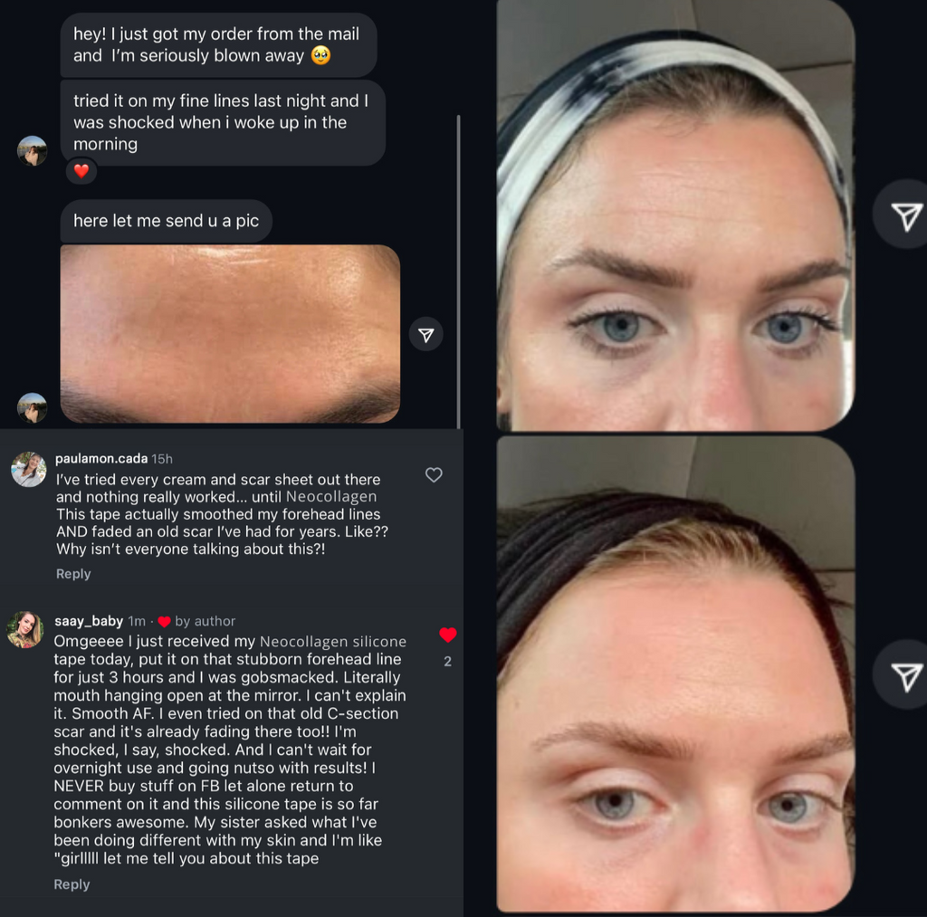 NEOCOLLAGEN™ Silicone Scar Sheets